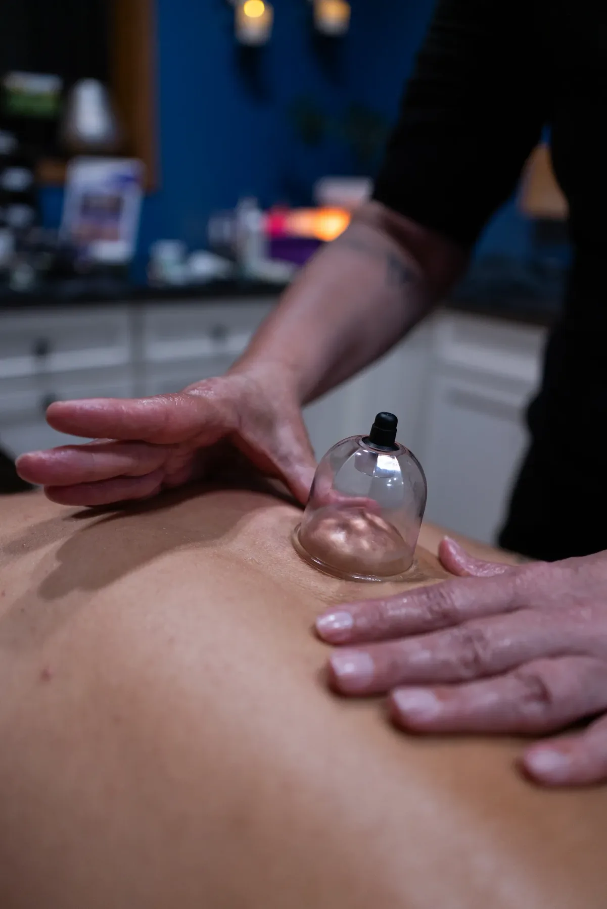 A cupping massage at Evolution of Beauty in Marshall, Minnesota, one of the services spa wallet credit can be put toward